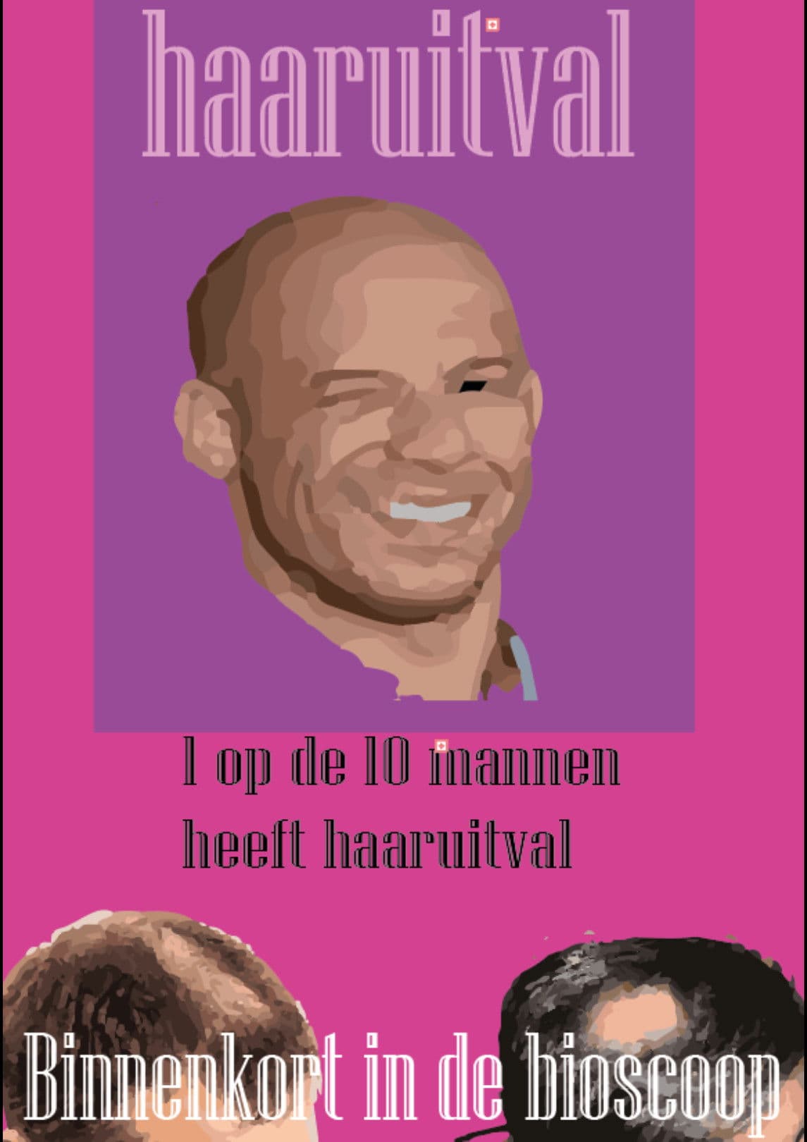 Kaal worden. Wat kan ik doen?